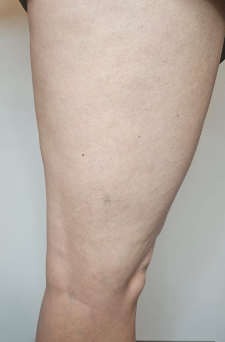 antes1.jpg antes1.jpg